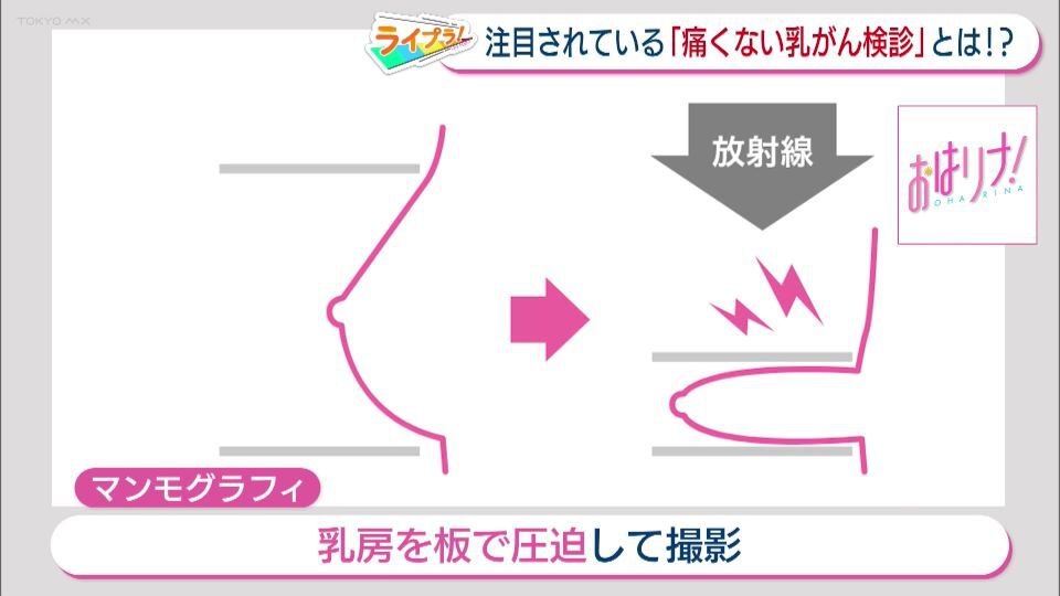 9人に1人がかかるものの検診受診率は50％以下…乳がん検診の新た