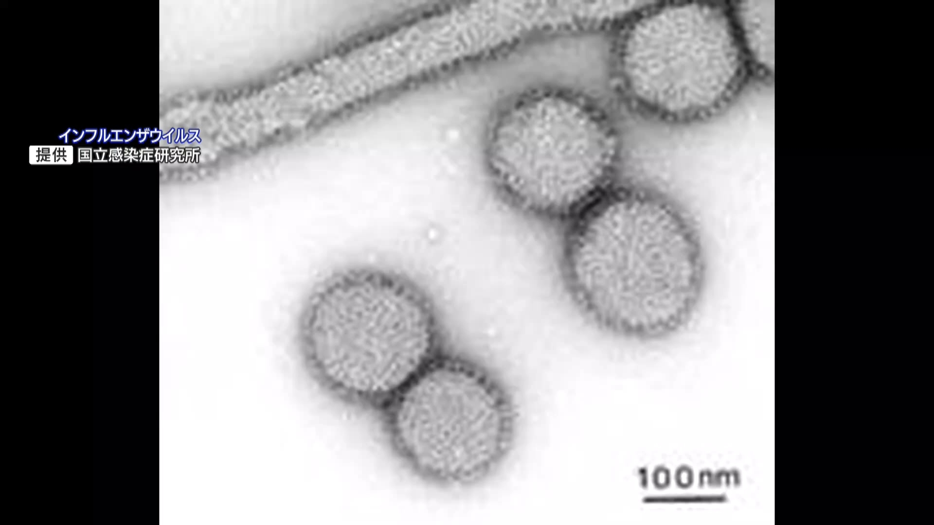 都内のインフルエンザ「注意報」の基準超　感染対策を呼びかけ