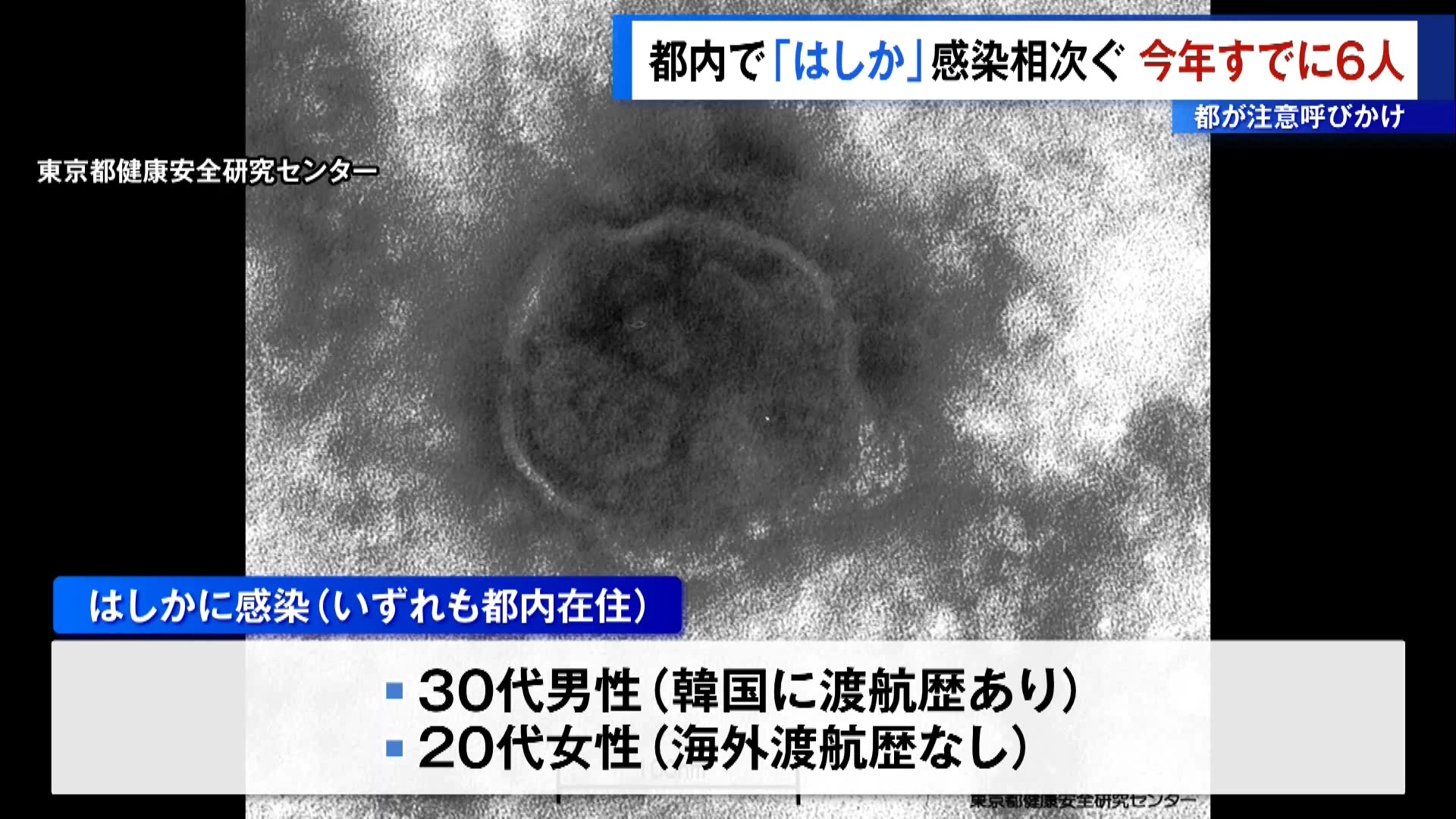 東京都内で「はしか」感染相次ぐ　今年すでに6人