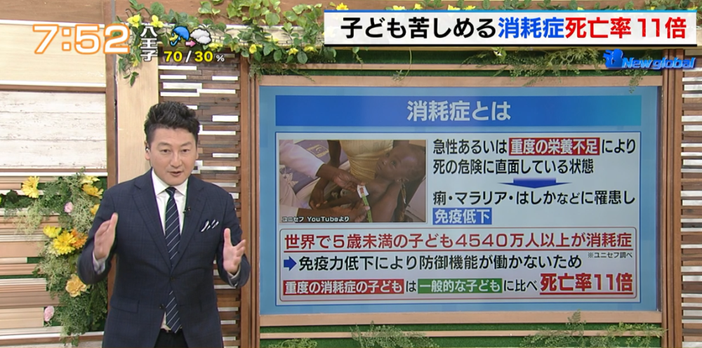 子どもたちを死に導く“消耗症”、食糧危機の裏で深刻な病が蔓延…日本にできることは？