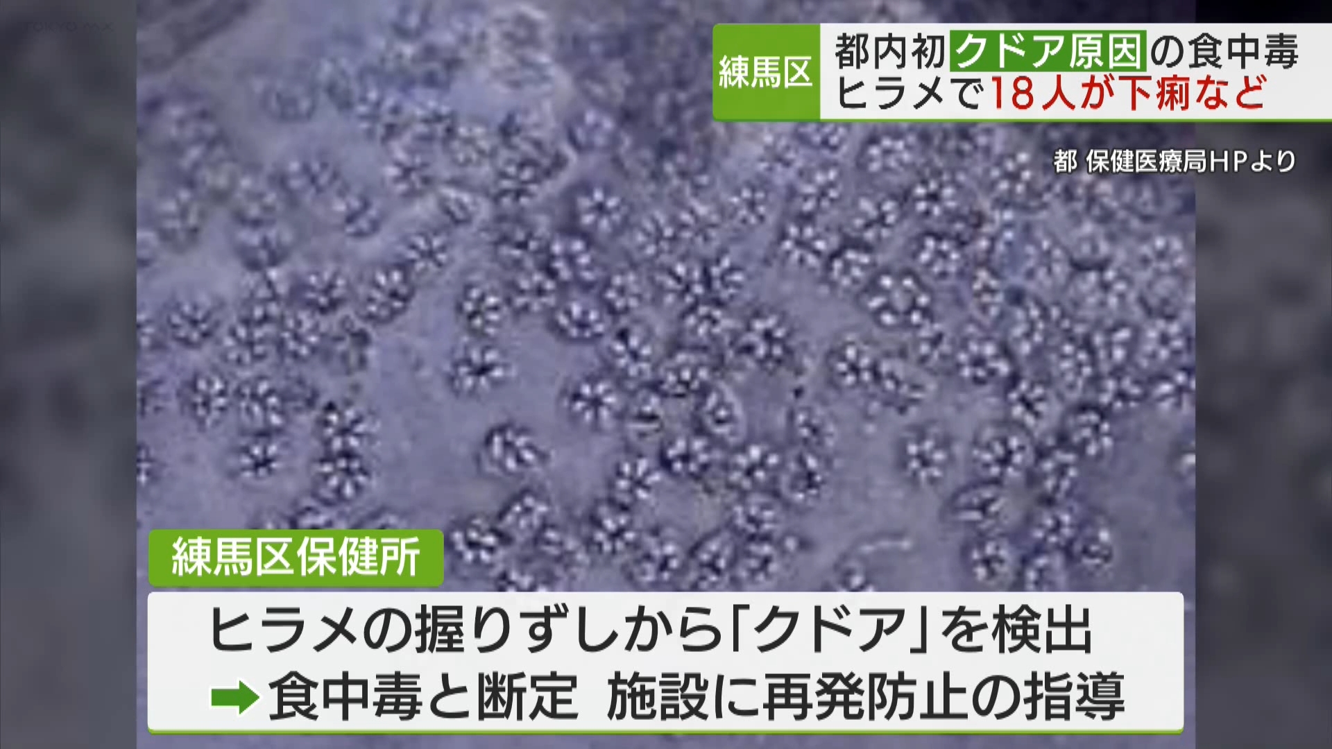 練馬区内の高齢者施設で、ヒラメに寄生する寄生虫「クドア」による食中毒が発生しました。クドアによる食中毒が東京都で発表されるのは初めてです。